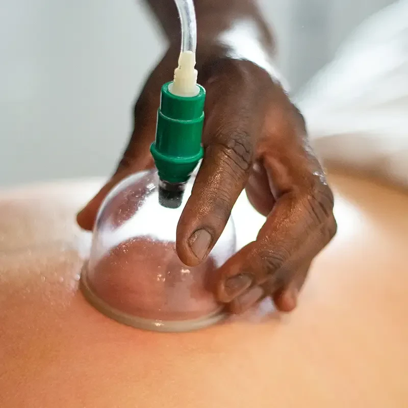 Cupping Massage Closeup