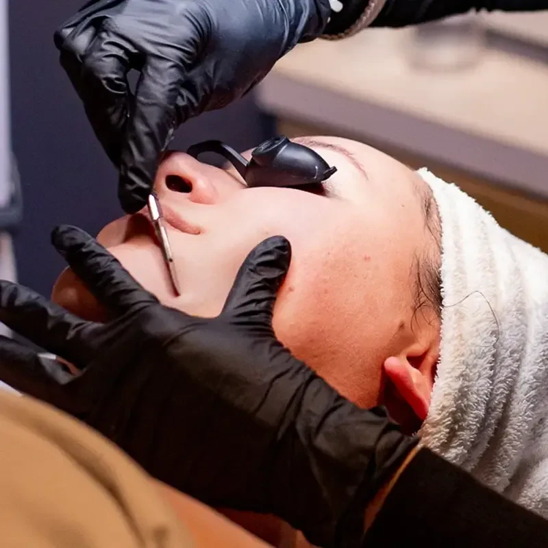 Professional Epidermal Leveling Closeup