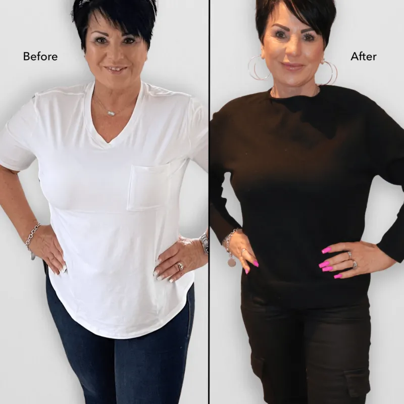 WeightLoss_Tirzepatide_BeforeAfter (1)