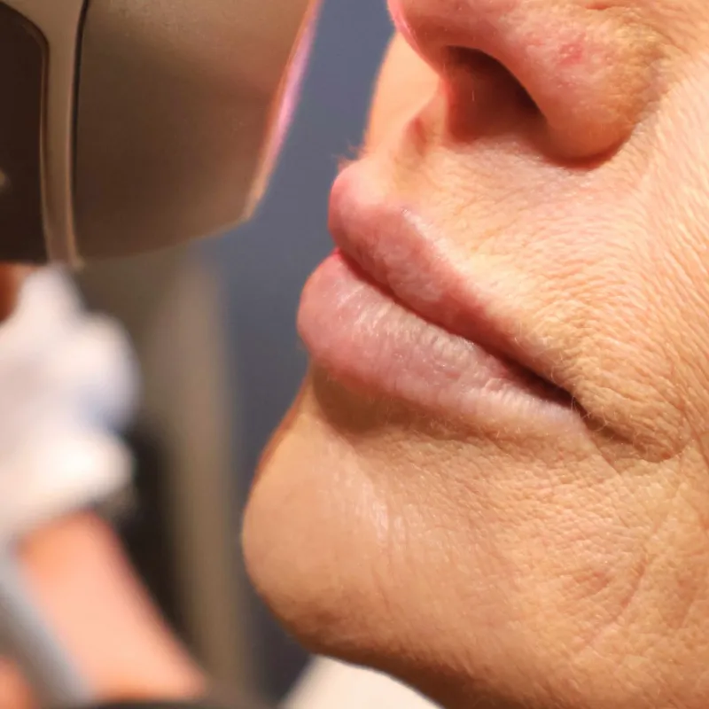 Medi_Laser Page Portrait Photos (4)